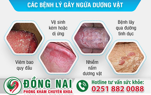 Các bệnh gây ngứa dương vật điển hình